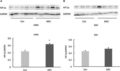 Effects of Remote Ischemic Preconditioning in Patients Undergoing Off-Pump Coronary Artery Bypass Graft Surgery